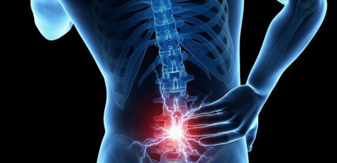 Bel Kaymaları / Spondilopatiler